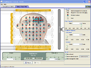 Simplified MRI Screenshot